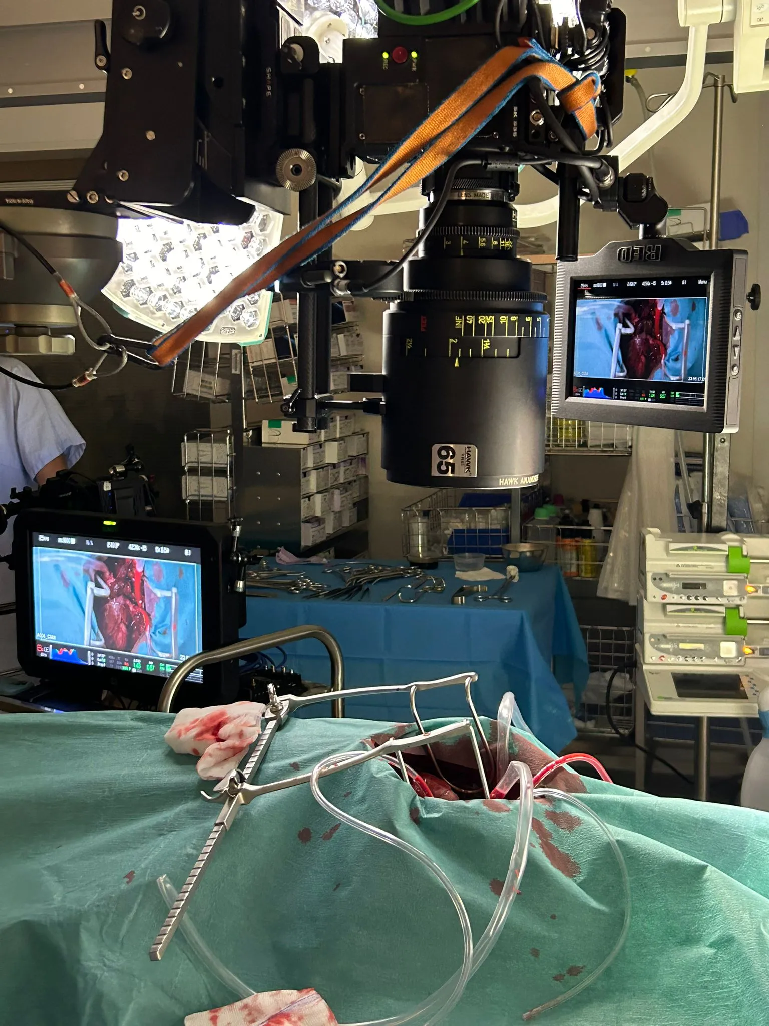 Tournage scène chirurgicale — précision technique